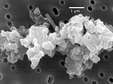 Mikrometeorit zvětšený elektronovým mikroskopem (foto: Donald E. Brownlee, University of Washington, Seattle, and Elmar Jessberger, Institut für Planetologie, Münster, Germany)
